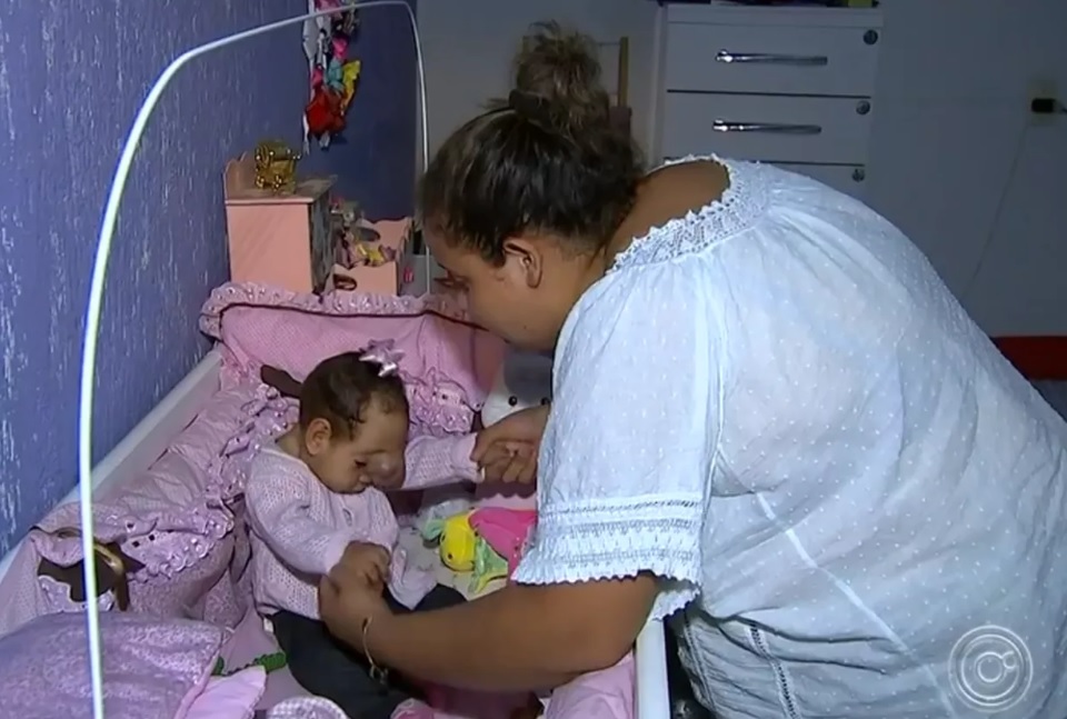 Família faz campanha para conseguir cirurgia de bebê doença rara