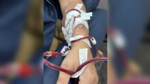 Hospital Regional de Coxim realizou 900 sessões de hemodiálise