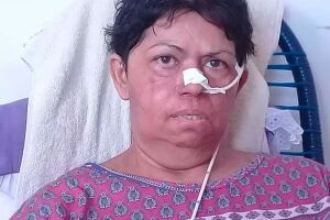 Afilhada apela por dinheiro para tratar madrinha com câncer no céu da boca em Campo Grande