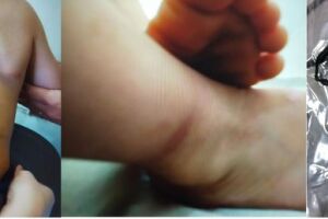 Polícia Civil investiga caso em que criança era amarrada com cadarço pelo tornozelo