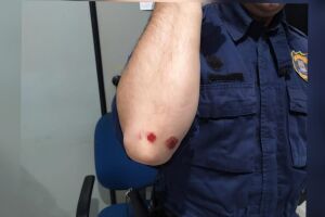 Guarda ficou com uniforme rasgado e escoriações pelo corpo após ser atropelado nas Moreninhas