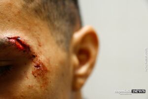 Natural de Aquidauana, ele não soube informar local das agressões