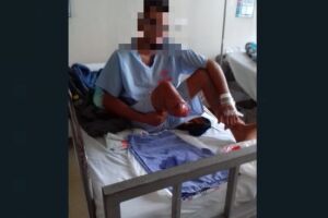 Esfaqueado e atropelado por pai e filho, rapaz tem perna amputada na Santa Casa