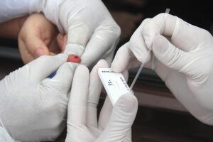 Secretaria de Saúde confirma casos de reinfecção da covid-19 em MS