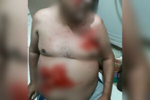 O homem foi socorrido pelo Corpo de Bombeiros