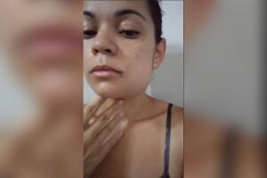 Mulher vive dias com dor por causa de procedimento