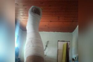 Mãe com pé quebrado precisa de doação de colchões para filhos