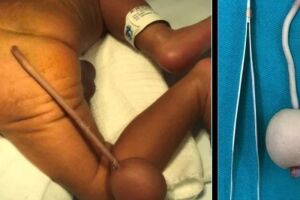 Bebê não teve qualquer alteração