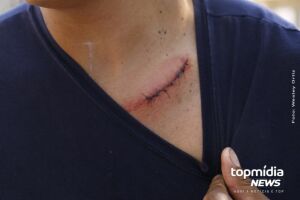 Homem esfaqueado por defender aluna relembra cena de terror em Campo Grande (vídeo)