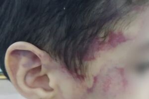 Criança foi agredida pelo lutador de Muay Thai