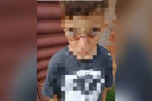 Garoto está com marcas nos olhos e nariz