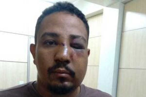 Cartomante foi agredido por cliente após ler tarô