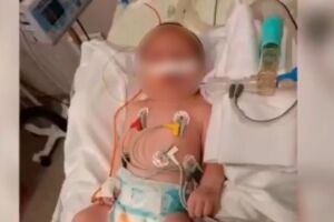 Bebê está intubado no HU por causa da H3N2