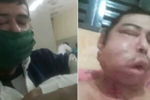 Homem precisa de ajuda até para medicamentos