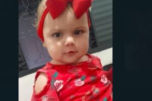 Menina apresentava manchas pelo corpo que chamaram a atenção das equipes médicas