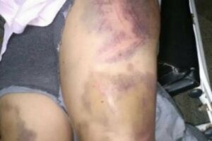 Mulher &eacute; espancada e arrastada pelos cabelos por terminar casamento em Tr&ecirc;s Lagoas