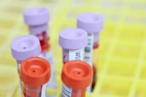 Saúde investiga seis mortes por suspeita de hepatite misteriosa em crianças e adolescentes
