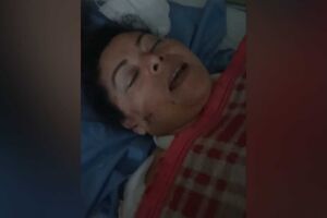 Mulher ficou com as marcas da violência no rosto