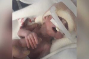 Bebezinho luta pela vida na UTI da Santa Casa