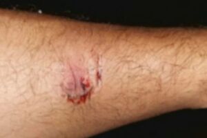 Mulher desce mordida no marido por não comprar cerveja no Jardim Canguru