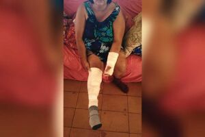 Eliane é diarista e vai ter de ficar um tempo sem trabalhar após o acidente