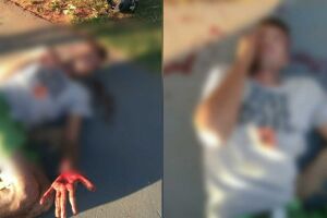 Acusado ficou ferido após as agressões