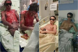 Com doença grave, rapaz faz vaquinha e mãe pede ajuda em Campo Grande
