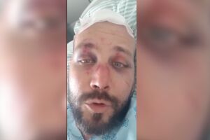 Fagner está internado na Santa Casa de Campo Grande