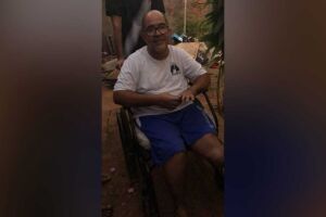 Jair teve uma das pernas amputada em um acidente