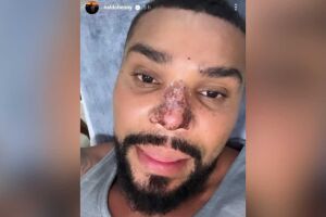 Naldo foi às redes sociais para falar sobre complicação