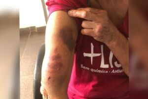 Espancada e vivendo em cárcere, mulher foge e consegue ajuda em hospital de Amambai