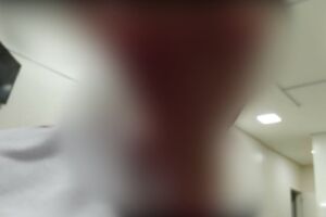 Ferimentos na mulher foram profundos 