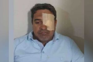 Vereador Vanderson Cardoso, de Chapadão do Sul, realiza cirurgia no olho 