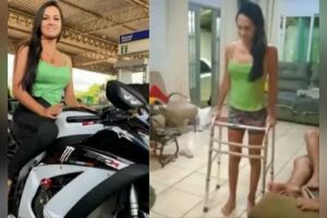 Enfermeira atropelada por defender mulher agredida volta a andar após 2 meses