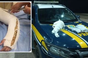 Mulher é presa com o 'braço quebrado' repleto de cocaína no Mato Grosso