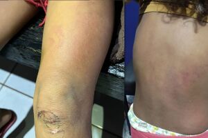 Delegado representa pela prisão preventiva de casal que torturou crianças em Chapadão do Sul