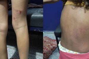 Crianças espancadas em Chapadão do Sul