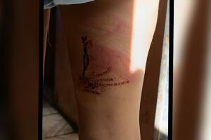 Ferimentos e marcas de sangue em uma das pernas da adolescente