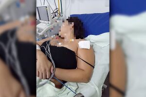 Mulher reage a assalto e toma tiro em Ponta Porã