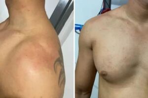 Fã diz que foi agredido por seguranças no show de Gusttavo Lima