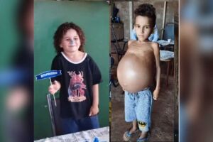 Antes e depois de Jo&atilde;o descobrir a doen&ccedil;a