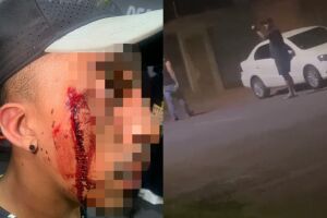 Barbeiro teve rosto cortado por policial de folga 