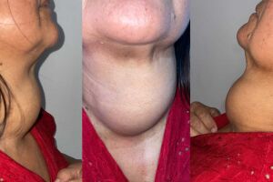 Dinheiro será usado tanto para pagar contas, como comprar remédios e alimentos