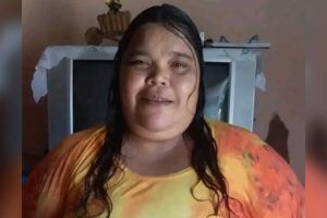 Mulher morre 45 dias depois em hospital após cair em residência em Campo Grande