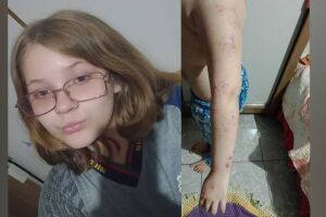 Criança de Sidrolândia depende de vacina de R$ 10 mil e enfrenta barreiras no SUS