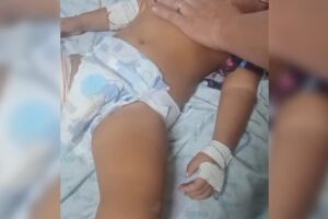 Bebê quase morreu por dose de morfina, diz mãe 