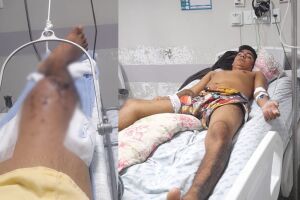 A espera de prótese para cirurgia, Thiago sofre com dores e está a base de morfina na Santa Casa