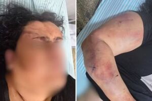 Homem é preso por agredir a companheira com pedaço de pau com pregos