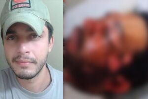 Homem atacado com água fervente em Anastácio vivia relacionamento abusivo com ex-companheira