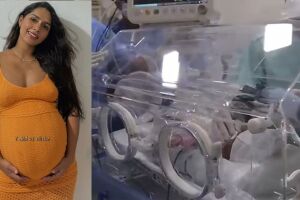 Gravida de quadrigêmeas da à luz quatro meninas saudáveis em Três Lagoas